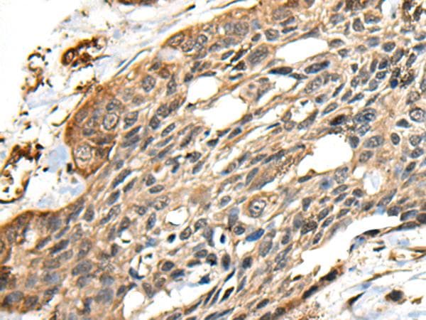 Polyclonal Rabbit anti-Human CCDC113 Antibody (IHC)