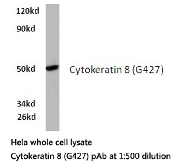 KRT8 / CK8 / Cytokeratin 8 Antibody (Gly427)