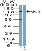 AP3D1 / Adaptin Delta Antibody (aa530-580)