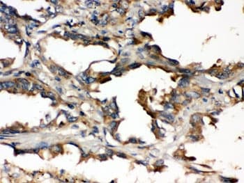 Polyclonal Rabbit anti-Human UBE2Q2 Antibody (IHC, WB)