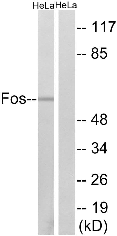 Polyclonal Rabbit anti-Human FOS / c-FOS Antibody (aa331-380, WB)