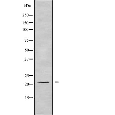 Polyclonal Rabbit anti-Human TRAPPC5 Antibody (IHC, WB)