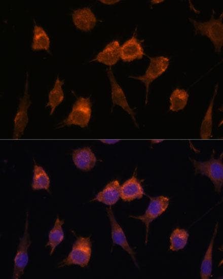 Polyclonal Rabbit anti-Human AVIL / Advillin Antibody (IF)