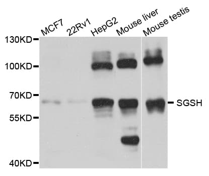 IHC-plus™ Polyclonal Rabbit anti-Human SGSH Antibody (IHC, WB)