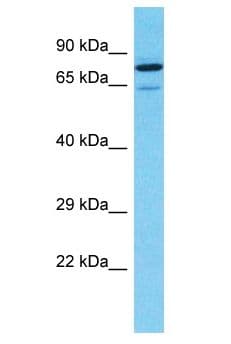 APC6 / CDC16 Antibody (aa72-121)