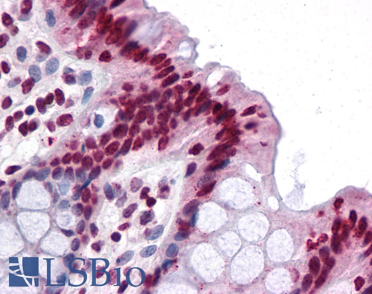 IHC-plus™ Polyclonal Rabbit anti-Human GAREML Antibody (IHC, IF, WB)