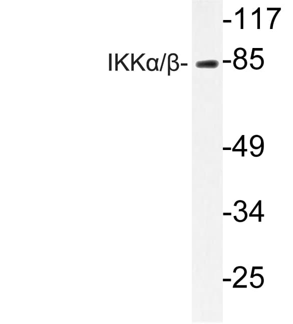 IKK Alpha+Beta Antibody (Asp173)