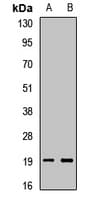 PTN / Pleiotrophin Antibody