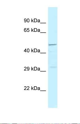 Polyclonal Rabbit anti-Human HRH3 / Histamine 3 Receptor Antibody (aa261-310, WB)