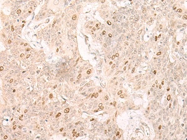 IL7 Antibody