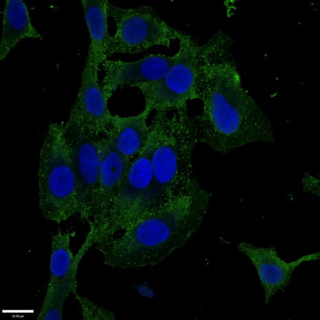 ZKSCAN3 / ZNF306 Antibody