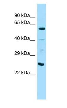 Polyclonal Rabbit anti-Mouse ANGPT1 / Angiopoietin-1 Antibody (aa360-409, WB)