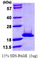 Human NME4 Protein (Recombinant His)