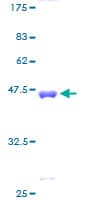 Human CSRP3 Protein (Recombinant GST)