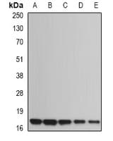 HR6B / UBE2B Antibody