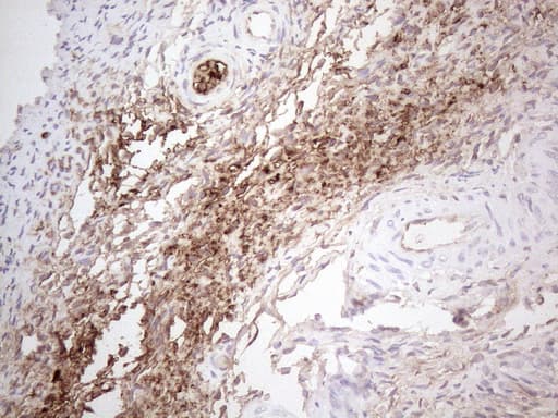 NOBOX Antibody (aa1-271, clone OTI4C5)