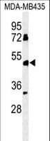 BTNL8 Antibody (aa257-285)