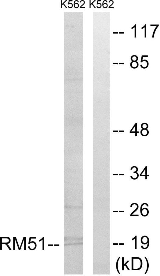 Polyclonal Rabbit anti-Human MRPL51 Antibody (IHC, WB)