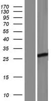 FBXO36 / F-Box Protein 36 (Over-Expression Lysate Myc-DDK (Flag))