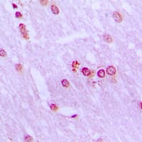 BRD3 Antibody (C-Terminus)