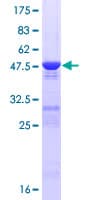 Human CRYGS Protein (Recombinant GST)
