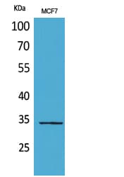 Polyclonal Rabbit anti-Human WDR83 Antibody (WB)