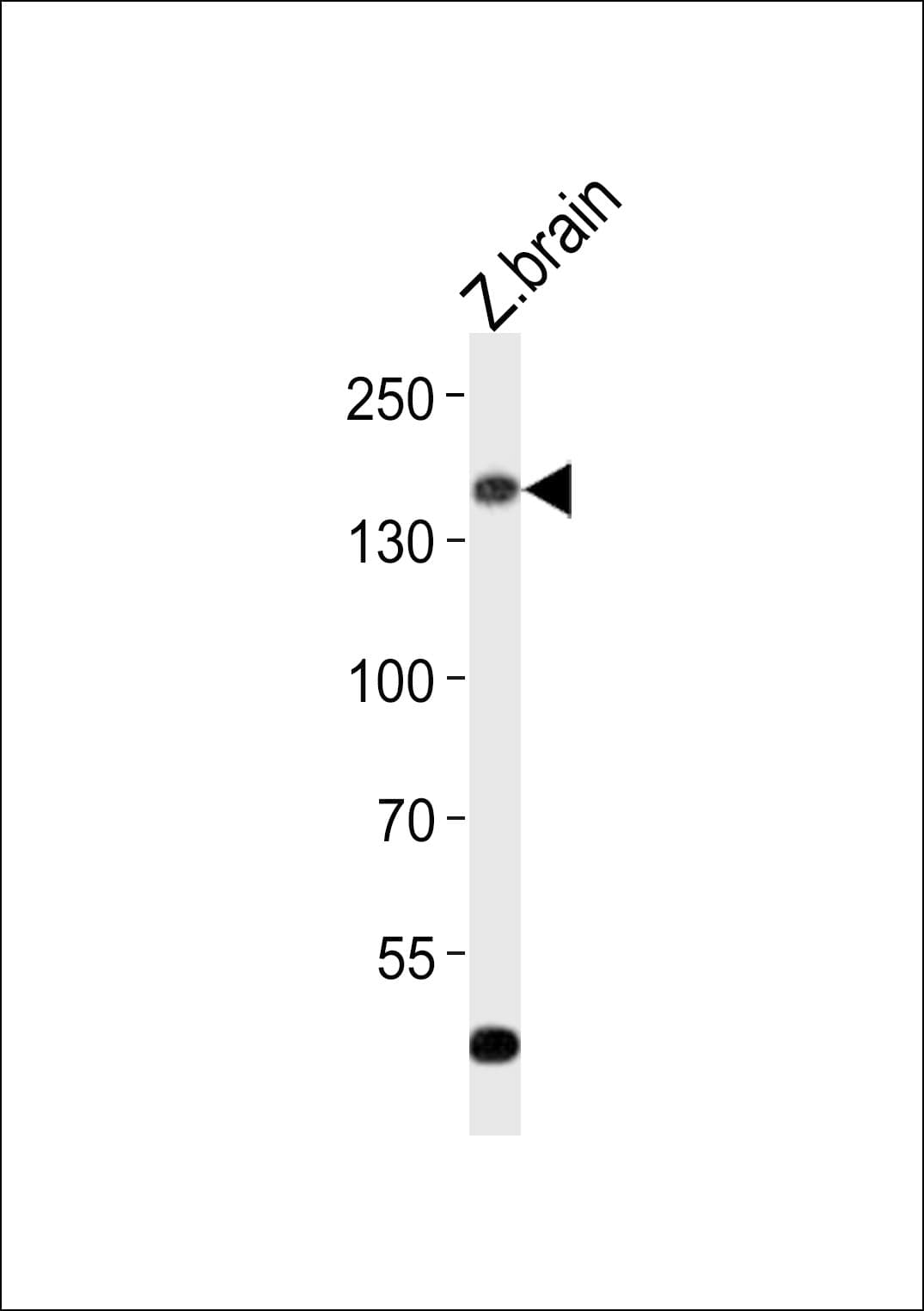 ADGRG6 / GPR126 Antibody (aa1135-1169)
