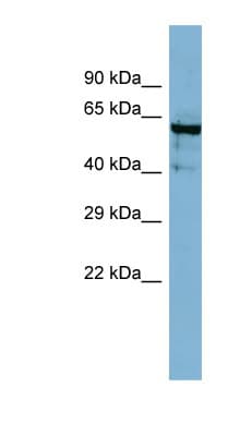 Polyclonal Rabbit anti-Human ANGPT4 / Angiopoietin-4 Antibody (aa35-84, WB)
