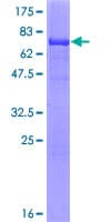 Human ADSS Protein (Recombinant GST)