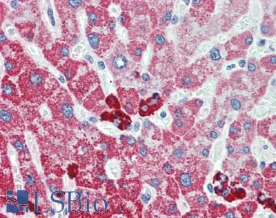 IHC-plus™ ALDH1B1 Antibody (aa278-517)