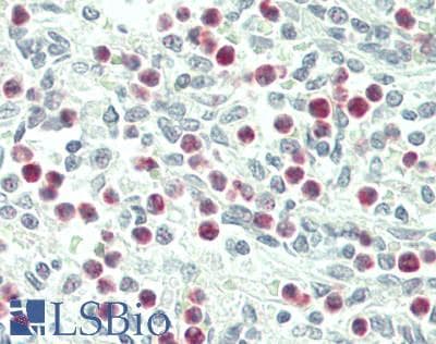 IHC-plus™ IL1F9 Antibody (clone 2F4)