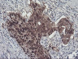 ACY1 / Aminoacylase 1 Antibody (clone OTI2F1)