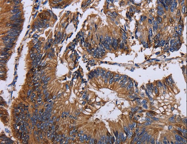 KRT31 / Keratin 31 / KRTHA1 Antibody