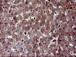 Monoclonal Mouse anti-Human MAP2K1 / MKK1 / MEK1 Antibody (clone OTI9E9, IHC, IF, WB)