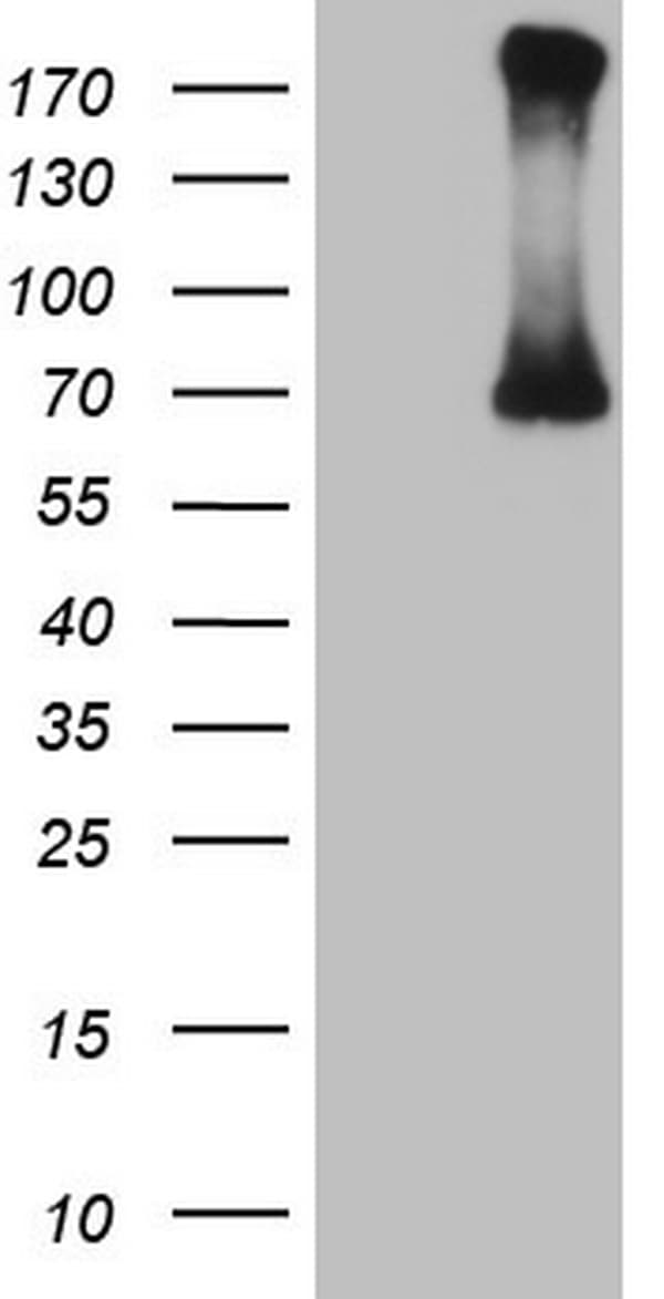 Monoclonal Mouse anti-Human CFI / Complement Factor I Antibody (clone OTI4H9, aa340-583, WB)