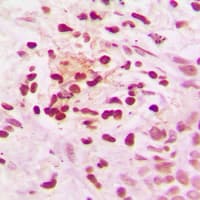 N-CoR / NCOR1 Antibody (N-Terminus)