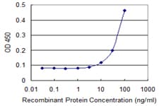 Monoclonal Mouse anti-Human ITPA Antibody (clone 2H8)