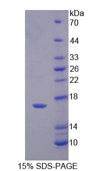 Human PFN4 Protein (Recombinant His, N-Terminal)