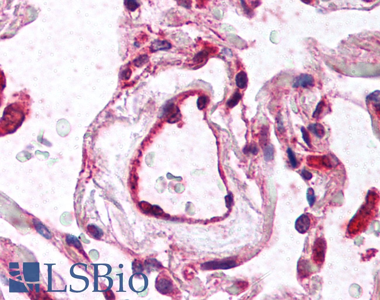 IHC-plus™ VEGFR-1/2 Antibody (aa800-900)