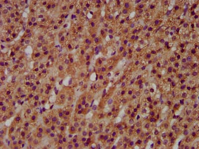 GNT-III / MGAT3 Antibody