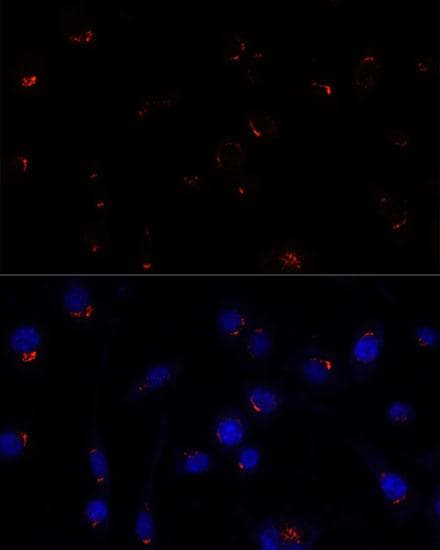 Polyclonal Rabbit anti-Human GOLGA5 Antibody (IF)
