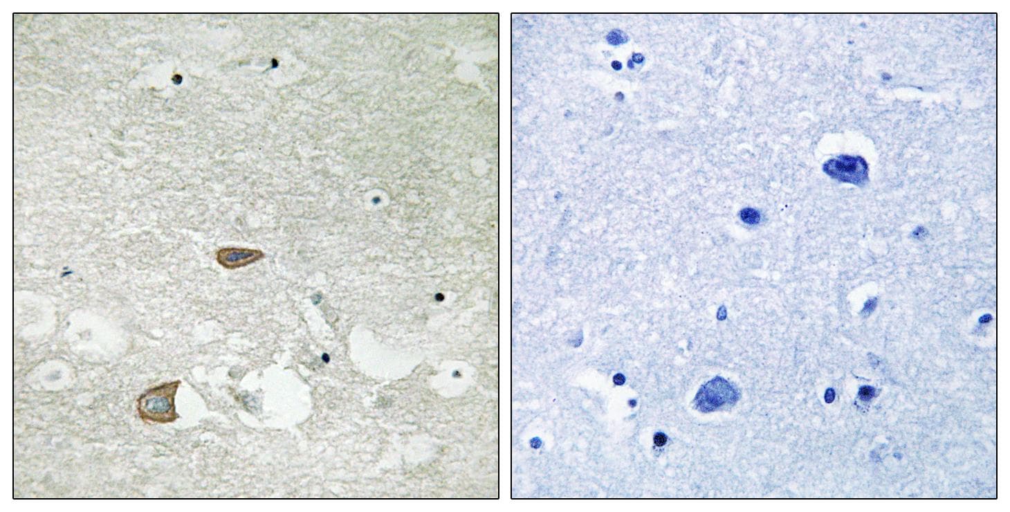 Polyclonal Rabbit anti-Human CELSR2 Antibody (IHC, IF)