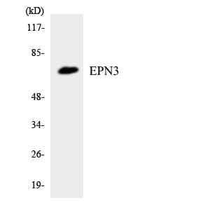 Polyclonal Rabbit anti-Human EPN3 Antibody (aa391-440, IHC, WB)