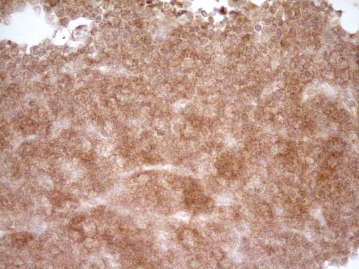 CD40 Antibody (aa21-166, clone OTI9F4)