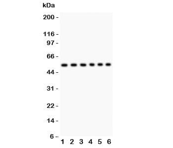 Polyclonal Rabbit anti-Human CD8 Antibody (aa22-187, IHC, WB)