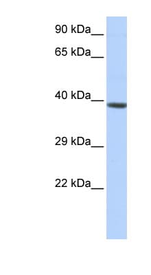 Polyclonal Rabbit anti-Human HOXA2 Antibody (C-Terminus, WB)
