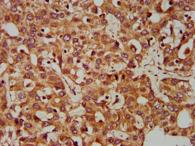 CLCC1 Antibody