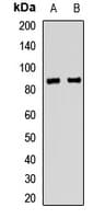 ERCC2 / XPD Antibody
