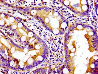 Kinesin Heavy Chain / KIF5B Antibody