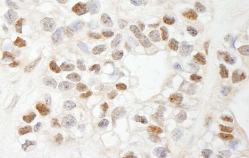 ATF7IP / MCAF1 Antibody (aa25-100)